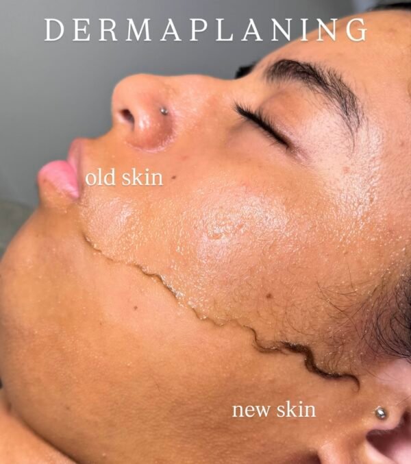 Dermaplane
