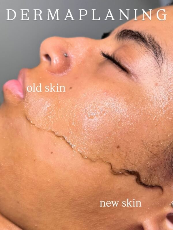 Dermaplane