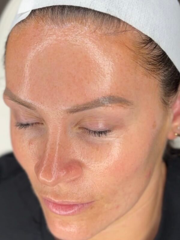 Hydrating Facial