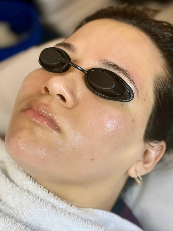 Express Facial